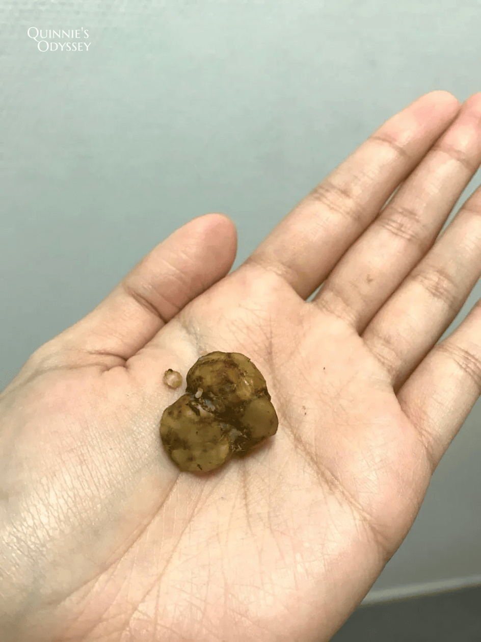 荷蘭迷幻蘑菇體驗心得:讓人瘋狂的迷幻蘑菇第二次體驗 - 第4張圖 迷幻蘑菇
